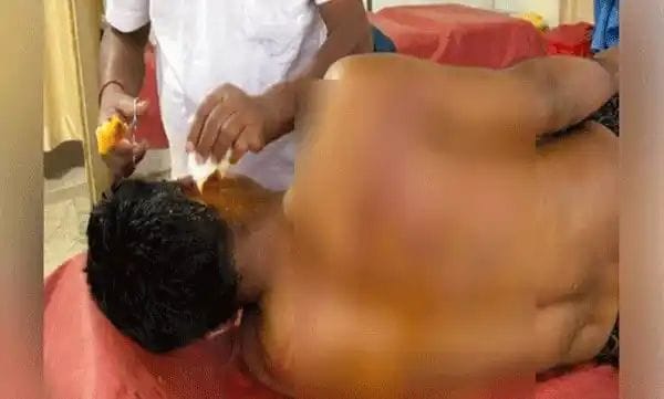 ഝാര്‍ഖണ്ഡില്‍ വീണ്ടും വൈദികര്‍ക്ക് നേരെ ആക്രമണം; 2 പേര്‍ക്ക് പരിക്ക്.