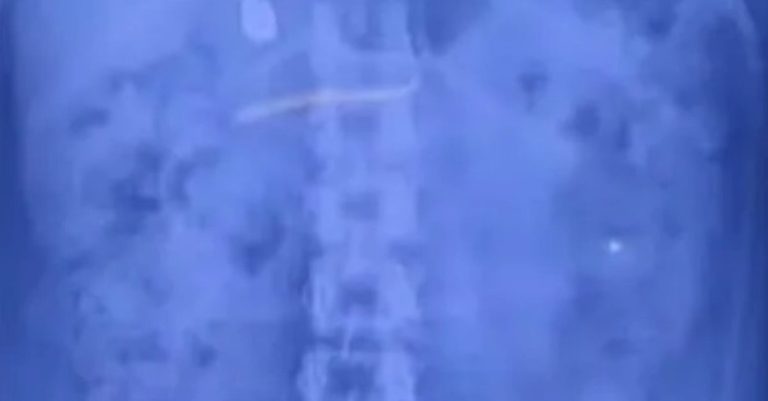 കുഞ്ഞിനെ ലാളിക്കുന്നതിനിടെ സ്വര്‍ണമാല വിഴുങ്ങി; യുവതി പിടിയില്‍